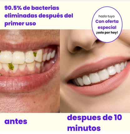 Irrigador Bucal Cleanteeth™ 4 en 1