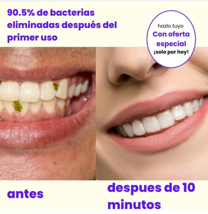 Irrigador Bucal Cleanteeth™ 4 en 1